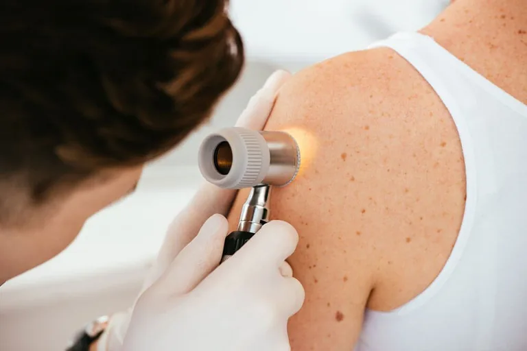 Skin examination with a dermatoscope