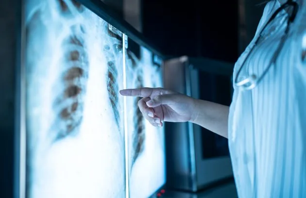 Clinician reviewing a chest X-ray